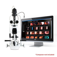 Carregar imagem no visualizador da galeria, HIS-5000 5X - US Ophthalmic